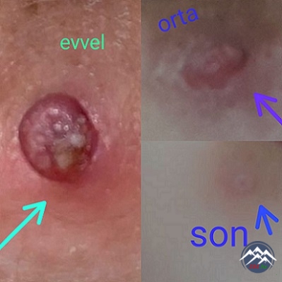 MÖCÜZƏVİ "ORXAN" MƏLHƏMİ